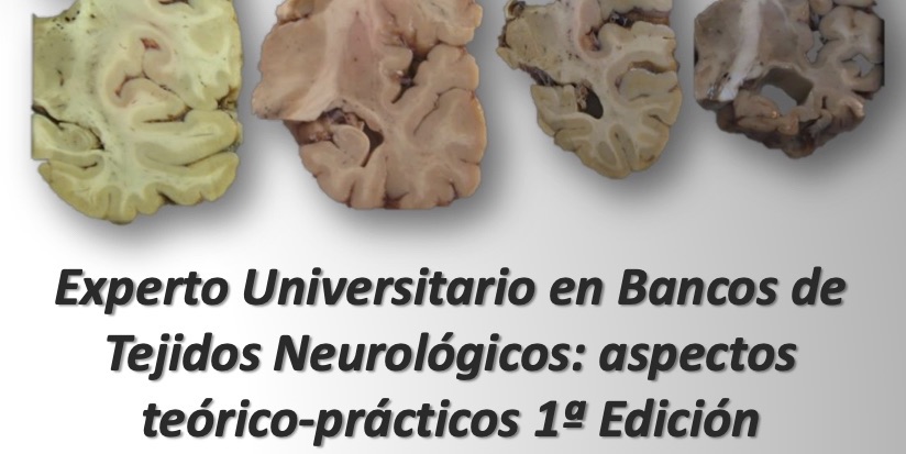 Primera edición del Curso de Experto en Bancos de Tejidos Neurológicos